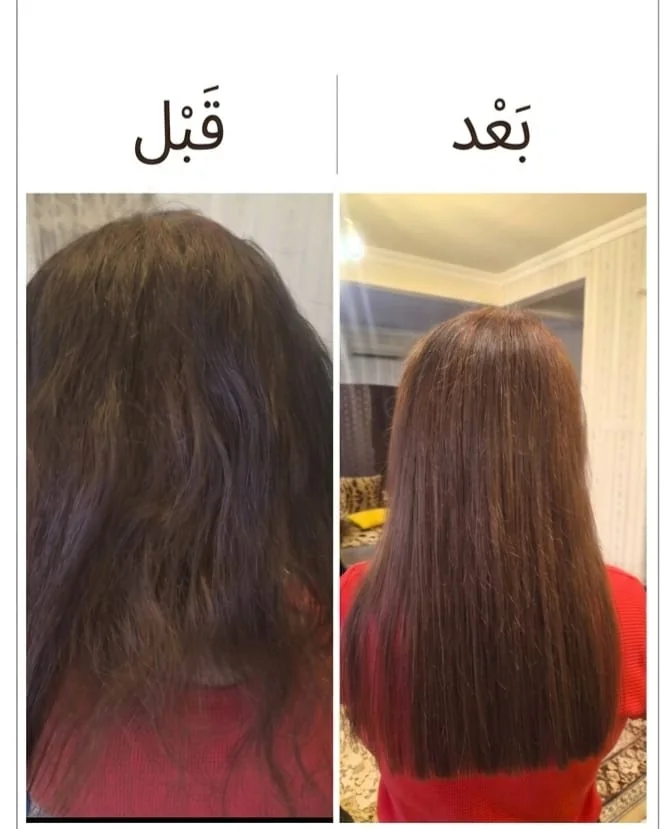 نتيجة حقيقية قبل وبعد تركيب الشعر — الحالة 1